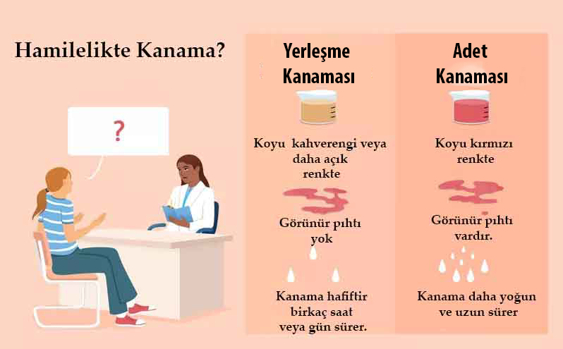yerleşme kanaması görüntüsü