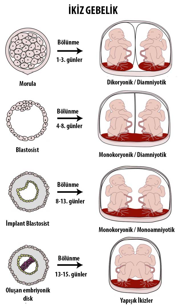 ikiz gebelik, çoğul gebelikler